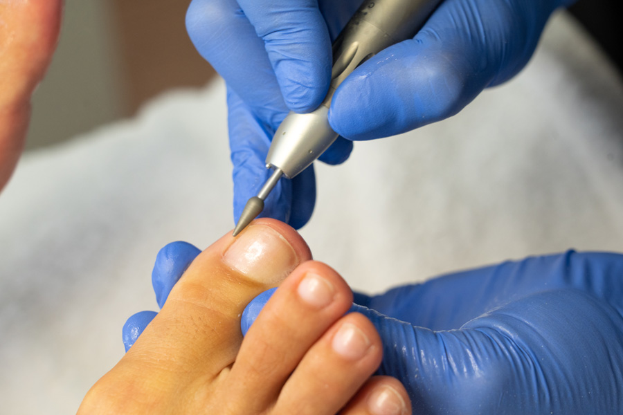 PEDICURE EXPERTS NEAR ME IN LIMASSOL PEDICURE EXPERTS NEAR ME IN LIMASSOL