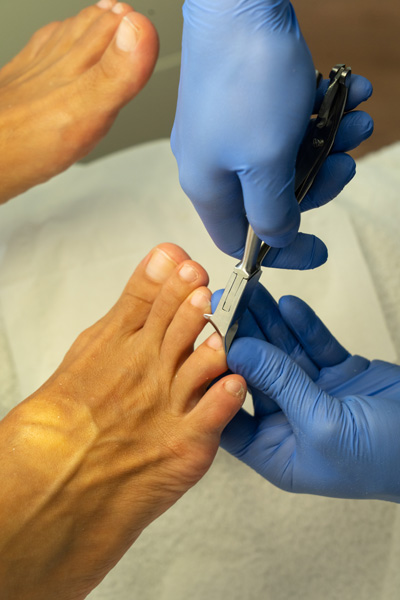 PEDICURES AT LIMASSOLS BEST BEAUTY SPA PEDICURES AT LIMASSOLS BEST BEAUTY SPA