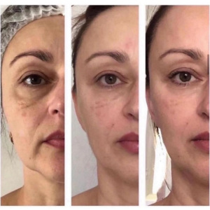 sculpting-face-massages-in-limassol